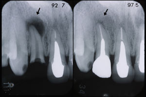 implant_s.jpg